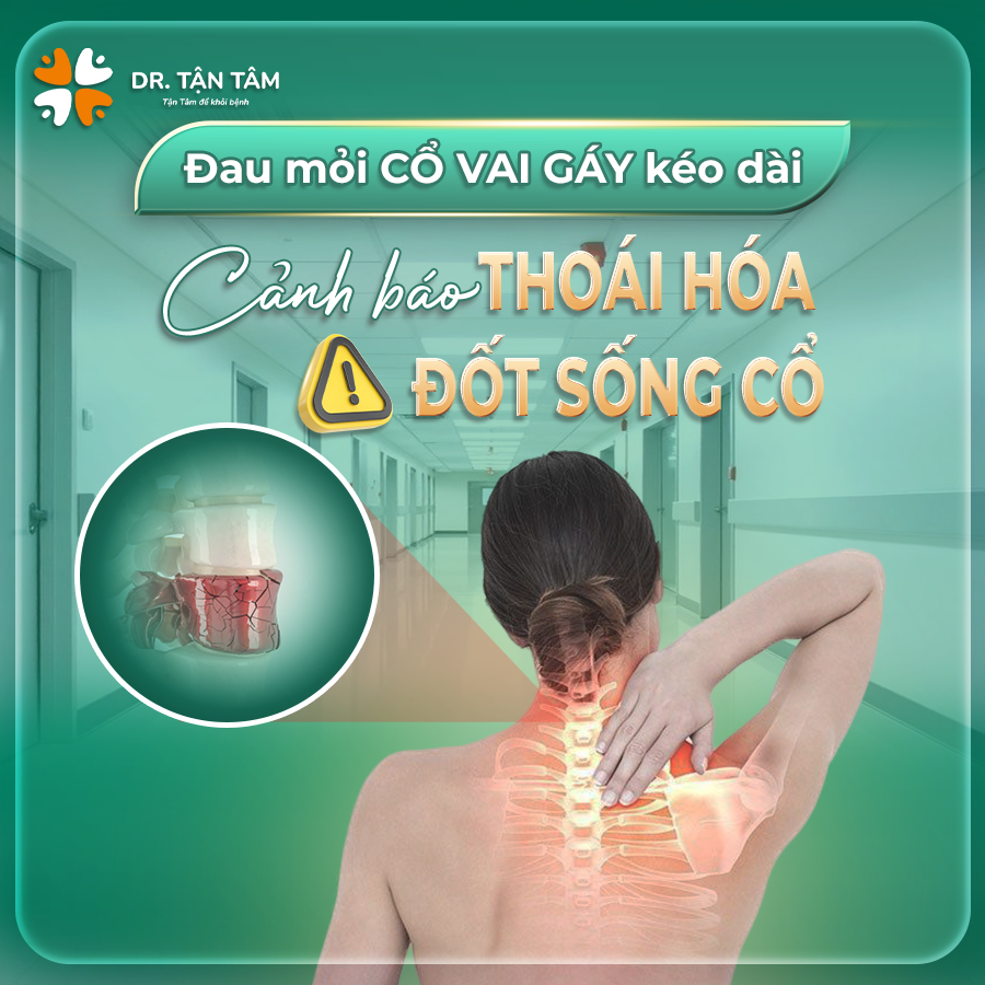 Gù Lưng & Cổ Rùa
