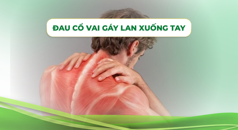 Đau cổ vai gáy lan xuống tay: Nguyên nhân, dấu hiệu và giải pháp